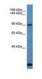 Collagen Type XXVII Alpha 1 Chain antibody, orb326322, Biorbyt, Western Blot image 