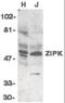 Death Associated Protein Kinase 3 antibody, orb86755, Biorbyt, Western Blot image 