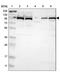 Ubiquitin Specific Peptidase 5 antibody, PA5-52341, Invitrogen Antibodies, Western Blot image 