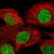 Tankyrase-1 antibody, HPA025690, Atlas Antibodies, Immunofluorescence image 