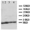 Apelin antibody, orb47968, Biorbyt, Western Blot image 