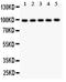 Hyperpolarization Activated Cyclic Nucleotide Gated Potassium Channel 1 antibody, PB9210, Boster Biological Technology, Western Blot image 