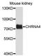 Cholinergic Receptor Nicotinic Alpha 4 Subunit antibody, orb373090, Biorbyt, Western Blot image 