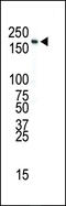 Insulin Receptor antibody, 63-104, ProSci, Western Blot image 