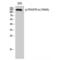 Platelet Derived Growth Factor Receptor Alpha antibody, LS-C381050, Lifespan Biosciences, Western Blot image 