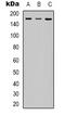 Insulin Receptor Substrate 1 antibody, LS-C368801, Lifespan Biosciences, Western Blot image 