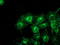 Tubulin Alpha Like 3 antibody, LS-C173525, Lifespan Biosciences, Immunofluorescence image 