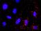 Phosphoinositide 3 kinase, p110 gamma antibody, H00008503-M02, Novus Biologicals, Proximity Ligation Assay image 