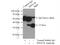 Protein Phosphatase 1 Catalytic Subunit Beta antibody, 10140-2-AP, Proteintech Group, Immunoprecipitation image 