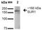 ATP Binding Cassette Subfamily C Member 8 antibody, orb67497, Biorbyt, Western Blot image 