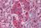 Fibroblast Growth Factor Receptor 1 antibody, MBS246151, MyBioSource, Immunohistochemistry paraffin image 