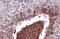 Alpha Fetoprotein antibody, GTX131311, GeneTex, Immunohistochemistry paraffin image 