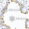 Collagen Type X Alpha 1 Chain antibody, A6889, ABclonal Technology, Immunohistochemistry paraffin image 