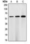 Checkpoint Kinase 1 antibody, LS-C352008, Lifespan Biosciences, Western Blot image 