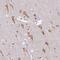 Zinc finger FYVE domain-containing protein 26 antibody, NBP2-31606, Novus Biologicals, Immunohistochemistry paraffin image 