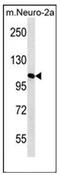 Mannosidase Alpha Class 2A Member 2 antibody, AP52594PU-N, Origene, Western Blot image 