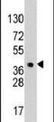 Heparin Binding Growth Factor antibody, PA5-13389, Invitrogen Antibodies, Western Blot image 