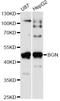 Biglycan antibody, LS-C746831, Lifespan Biosciences, Western Blot image 