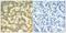 Spleen Associated Tyrosine Kinase antibody, GTX50355, GeneTex, Immunohistochemistry paraffin image 