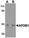 AP2M1 antibody, PA5-20745, Invitrogen Antibodies, Western Blot image 