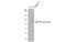 Interleukin 10 Receptor Subunit Alpha antibody, GTX102731, GeneTex, Western Blot image 