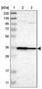 Lymphocyte Transmembrane Adaptor 1 antibody, PA5-51711, Invitrogen Antibodies, Western Blot image 