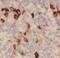 Cytotoxic T-lymphocyte protein 4 antibody, FNab09937, FineTest, Immunohistochemistry frozen image 
