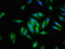 Deltex E3 Ubiquitin Ligase 1 antibody, LS-C671696, Lifespan Biosciences, Immunofluorescence image 