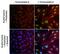 Pmp70 antibody, MA1-2021, Invitrogen Antibodies, Immunofluorescence image 