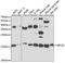 Ribosomal Protein S25 antibody, GTX66357, GeneTex, Western Blot image 