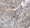 Calcyphosine 2 antibody, FNab01198, FineTest, Immunohistochemistry paraffin image 