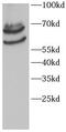 Serine Peptidase Inhibitor, Kunitz Type 1 antibody, FNab10792, FineTest, Western Blot image 