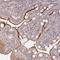 Trichoplein Keratin Filament Binding antibody, HPA038638, Atlas Antibodies, Immunohistochemistry frozen image 