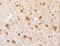 AE Binding Protein 2 antibody, LS-C401193, Lifespan Biosciences, Immunohistochemistry paraffin image 