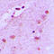 Nucleophosmin 1 antibody, LS-C352604, Lifespan Biosciences, Immunohistochemistry frozen image 