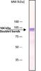 Adaptor Related Protein Complex 1 Subunit Gamma 1 antibody, GTX11328, GeneTex, Western Blot image 