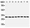 Voltage Dependent Anion Channel 1 antibody, PA1780, Boster Biological Technology, Western Blot image 