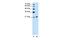 Ankyrin-1 antibody, PA5-42203, Invitrogen Antibodies, Western Blot image 