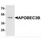 Apolipoprotein B MRNA Editing Enzyme Catalytic Subunit 3B antibody, TA349029, Origene, Western Blot image 