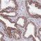 NADH:Ubiquinone Oxidoreductase Subunit B6 antibody, NBP1-92172, Novus Biologicals, Immunohistochemistry paraffin image 