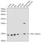 Frataxin antibody, GTX54036, GeneTex, Western Blot image 