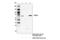 Protein Arginine Methyltransferase 5 antibody, 79998S, Cell Signaling Technology, Immunoprecipitation image 