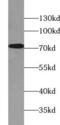 Potassium Voltage-Gated Channel Subfamily A Member 4 antibody, FNab04664, FineTest, Western Blot image 