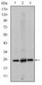 Eukaryotic Translation Initiation Factor 4E antibody, M00135-1, Boster Biological Technology, Western Blot image 