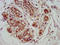 GATA Zinc Finger Domain Containing 2A antibody, LS-C673074, Lifespan Biosciences, Immunohistochemistry paraffin image 