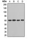 IKAROS Family Zinc Finger 2 antibody, LS-C668762, Lifespan Biosciences, Western Blot image 