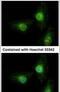 Nuclear Receptor Coactivator 3 antibody, MA1-23150, Invitrogen Antibodies, Immunofluorescence image 