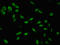 SWI/SNF Related, Matrix Associated, Actin Dependent Regulator Of Chromatin, Subfamily D, Member 1 antibody, LS-C672015, Lifespan Biosciences, Immunofluorescence image 