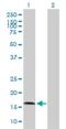 Angiotensin II Receptor Associated Protein antibody, H00057085-B01P, Novus Biologicals, Western Blot image 