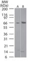 Fli-1 Proto-Oncogene, ETS Transcription Factor antibody, NB100-56306, Novus Biologicals, Western Blot image 